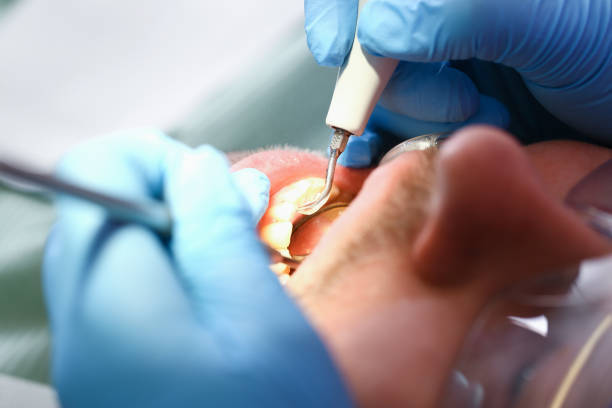 Best Dentist for Tooth Abscess  in Liberty, PA
