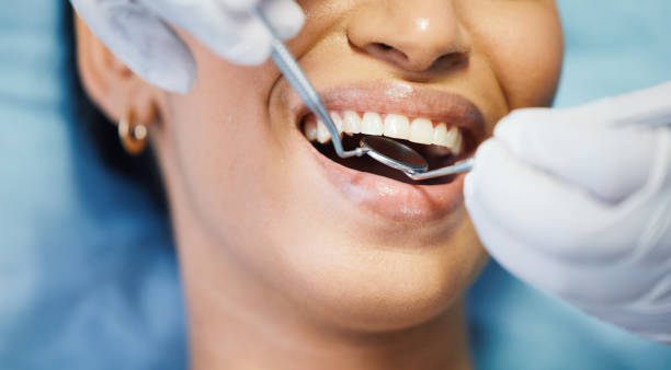 Best Chipped Tooth Repair Near Me  in Liberty, PA
